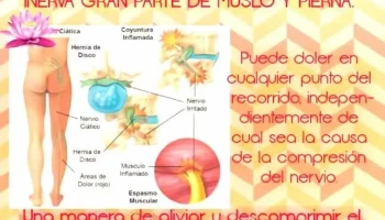Kinesiología y fisioterapia. Lic. Monzón Daniela - Juárez Celman